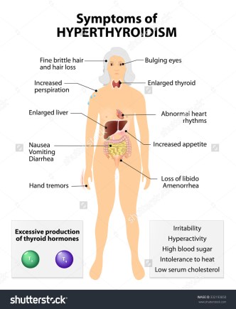 stock-vector-hyperthyroidism-or-over-active-thyroid-hyperthyreosis-signs-and-symptoms-thyroid-dysfunction-332193650
